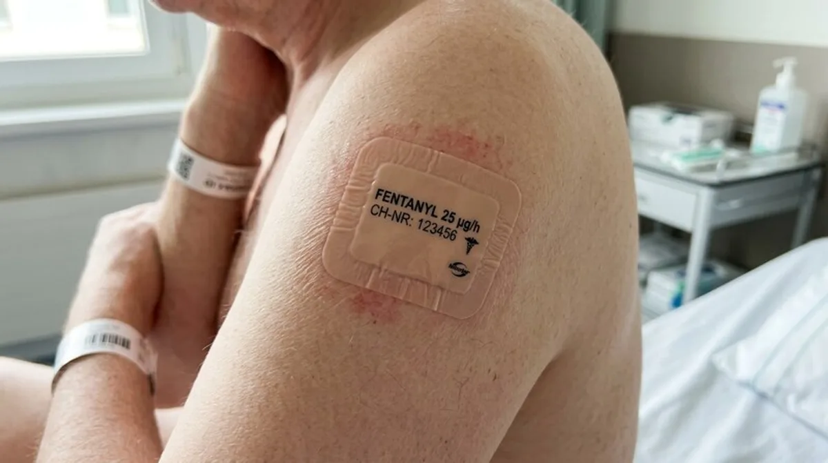Fentanyl-Pflaster am Arm — transdermales Schmerzmittel, 100-mal stärker als Morphin